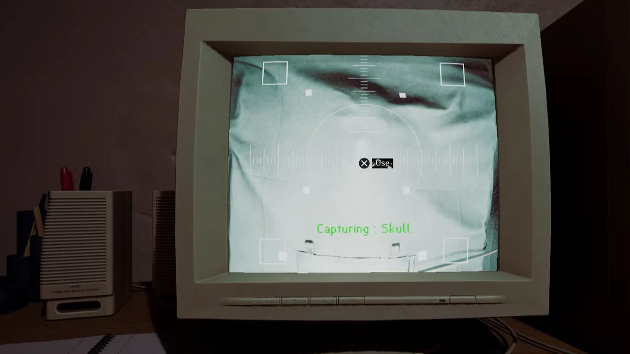 Компьютерный монитор со светлым рентгеновским изображением в Silent Hill: Townfall